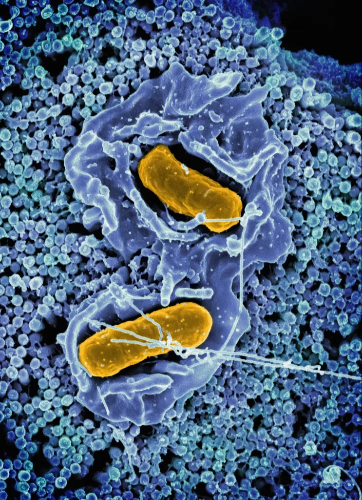 Salmonella-Typhimurium-Scanning-electron-micrograph-of-Salmonella-Typhimurium-invading-a-human-epithelial-cell